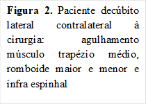 Figura 2. Paciente decúbito lateral contralateral à cirurgia: agulhamento músculo trapézio médio, romboide maior e menor e infra espinhal