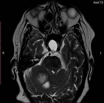Foto preta e branca de um urso de pelúcia
O conteúdo gerado por IA pode estar incorreto.
