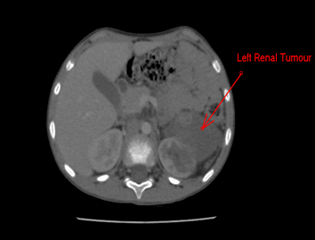 Imagem em preto e branco

O conteúdo gerado por IA pode estar incorreto.