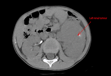 Foto preta e branca de um bolo

O conteúdo gerado por IA pode estar incorreto.