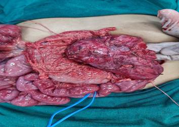 Uma imagem contendo pessoa, comida, mulher, pequeno

O conteúdo gerado por IA pode estar incorreto.