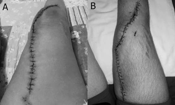 Tatuagem no braço

O conteúdo gerado por IA pode estar incorreto.