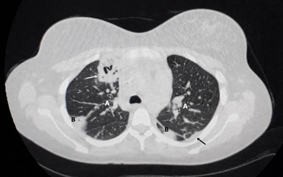 Foto preta e branca de relógio ao fundo

O conteúdo gerado por IA pode estar incorreto.